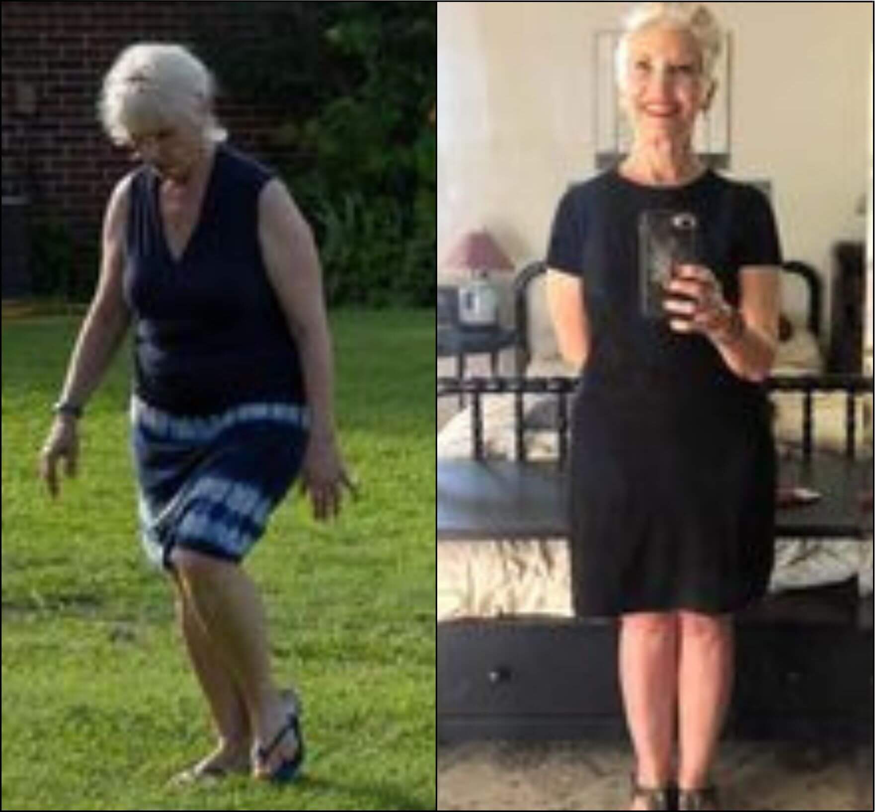 https://www.nobsweightloss.com/wp-content/uploads/2023/11/Susan-Two-pictures-of-an-older-woman-before-and-after-a-weight-loss-program.jpg