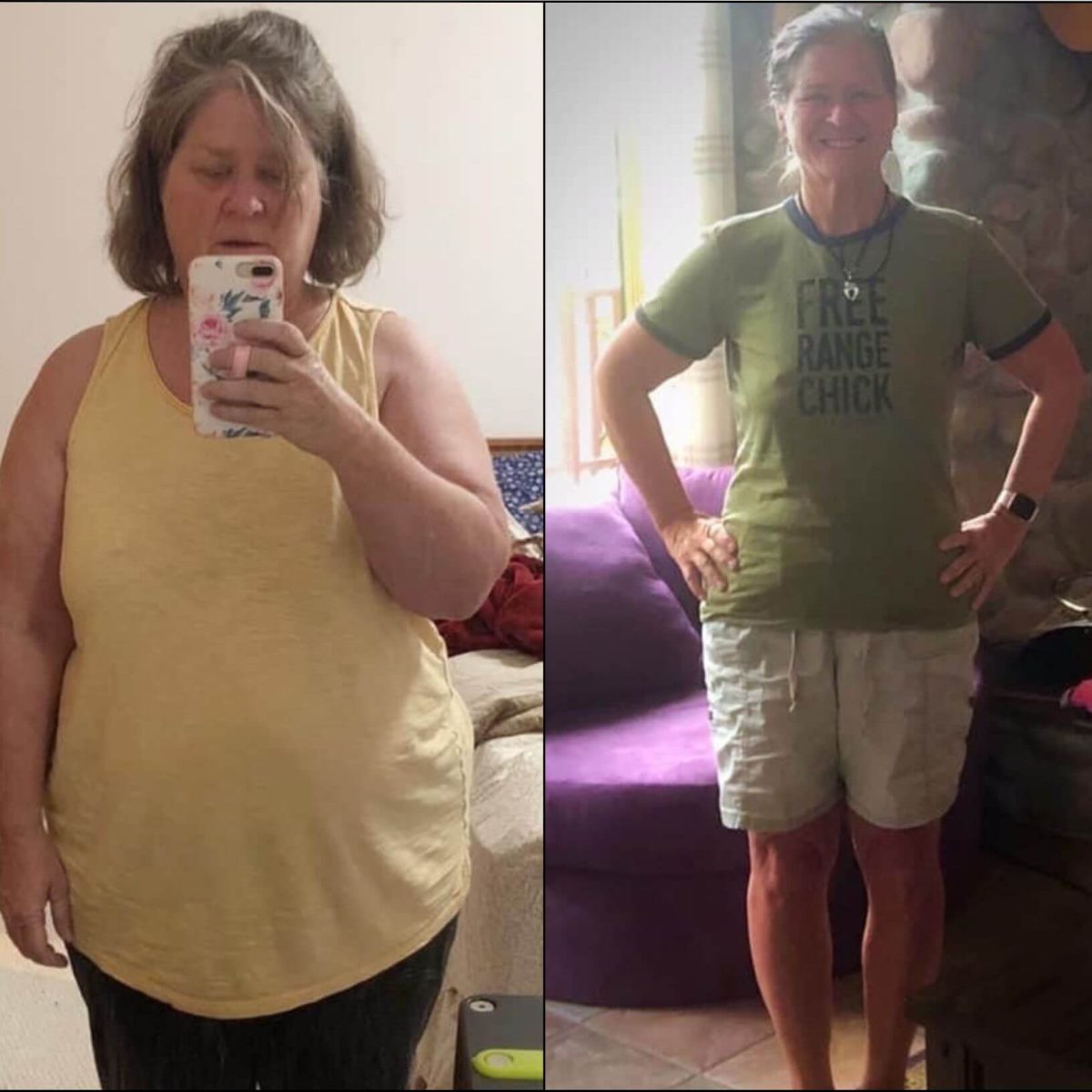 Two pictures of a woman before and after weight loss