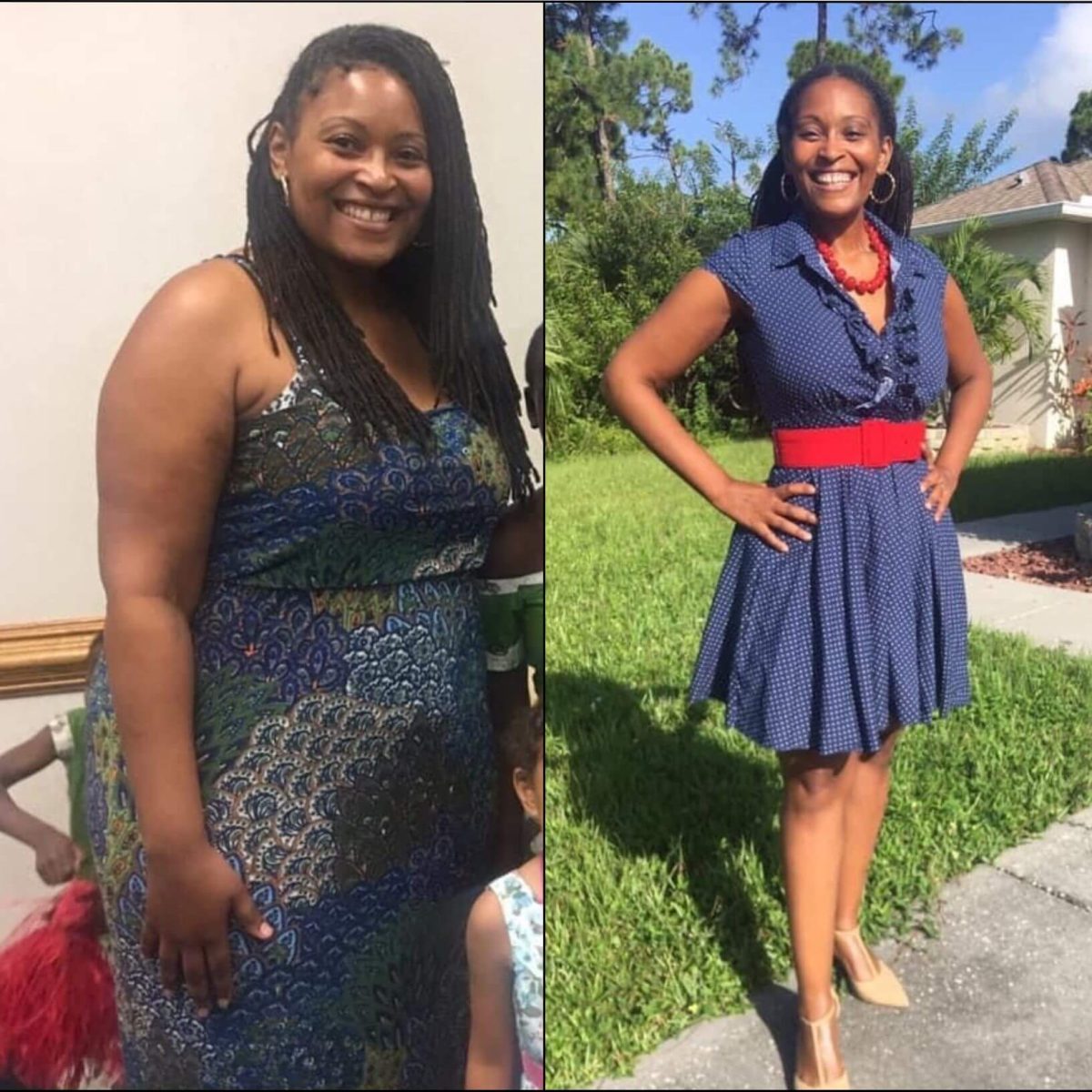 Devon - Two pictures of a woman before and after weight loss.