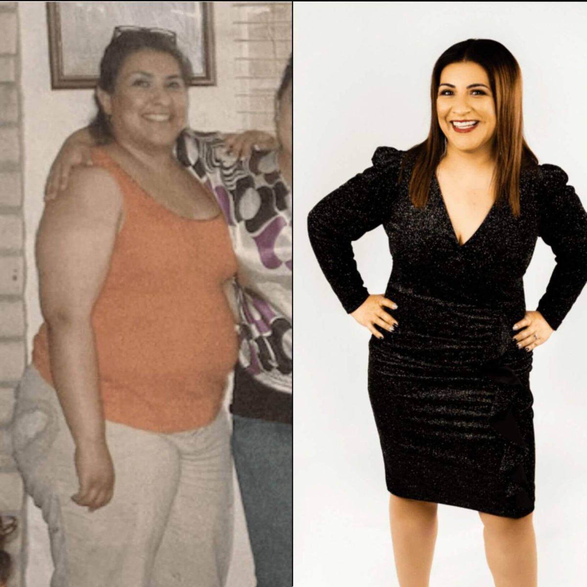 Two photos of a woman before and after weight loss.