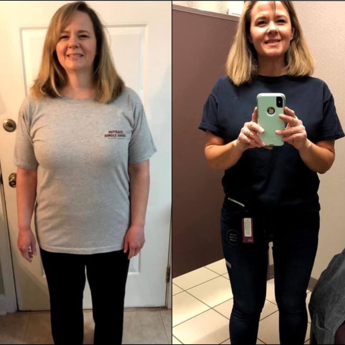 Two pictures of a woman before and after her weight loss.