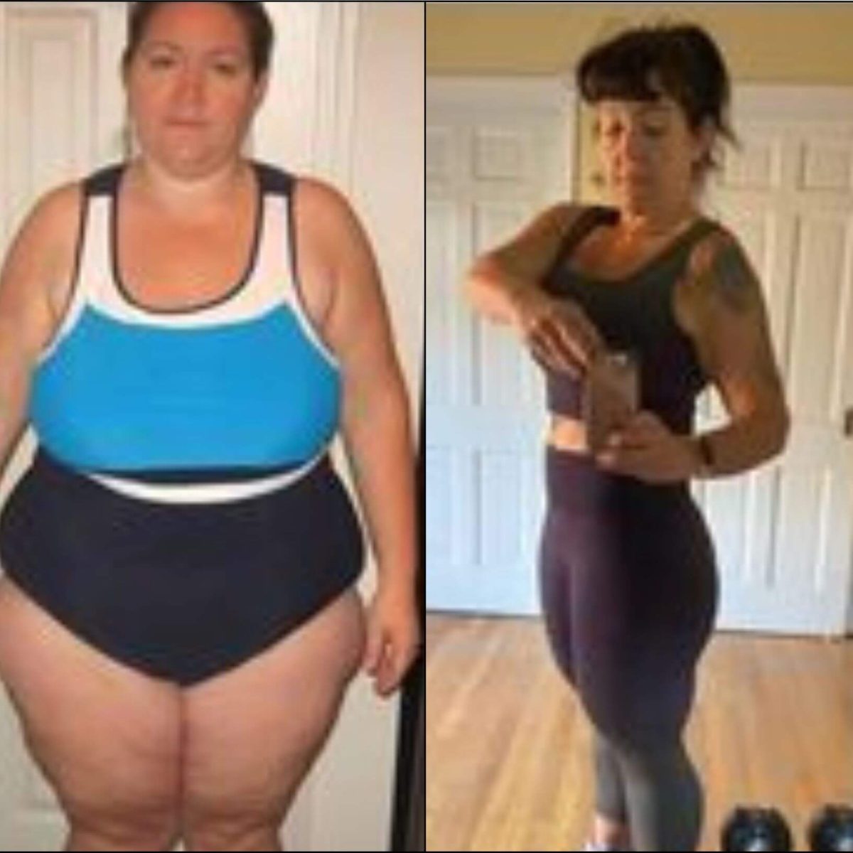 Two pictures of a woman before and after weight loss.