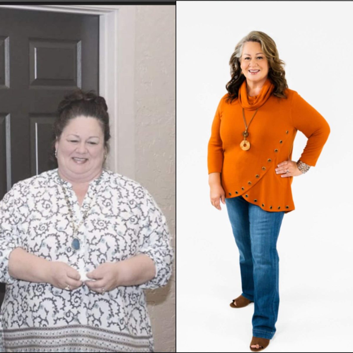 Two pictures of a woman before and after weight loss.