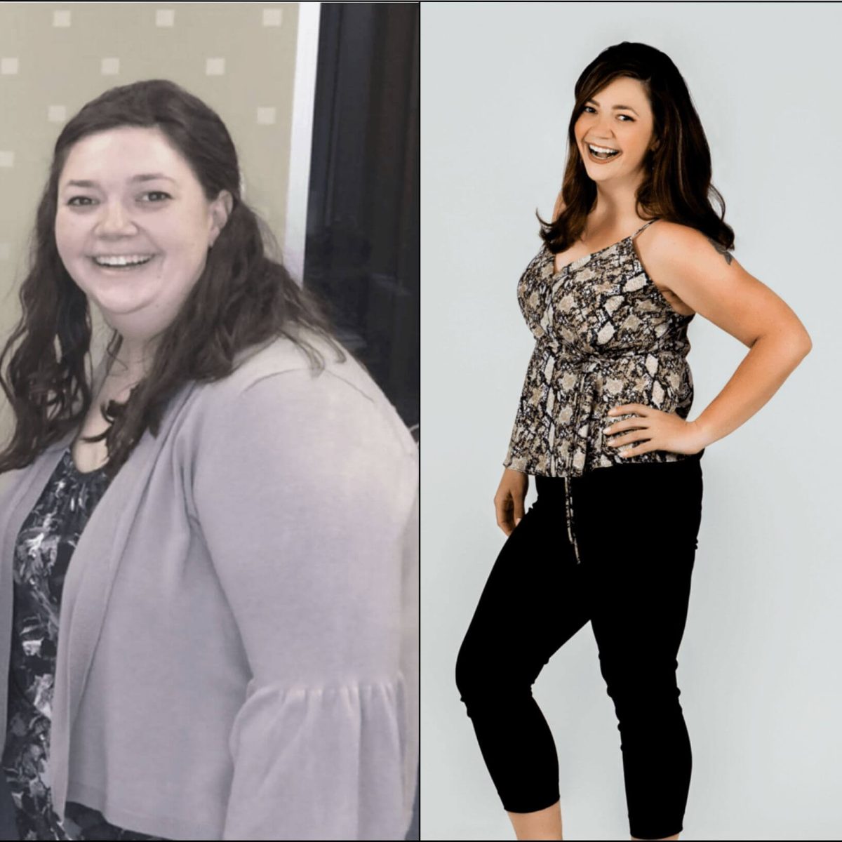 Two pictures of a woman before and after her weight loss.