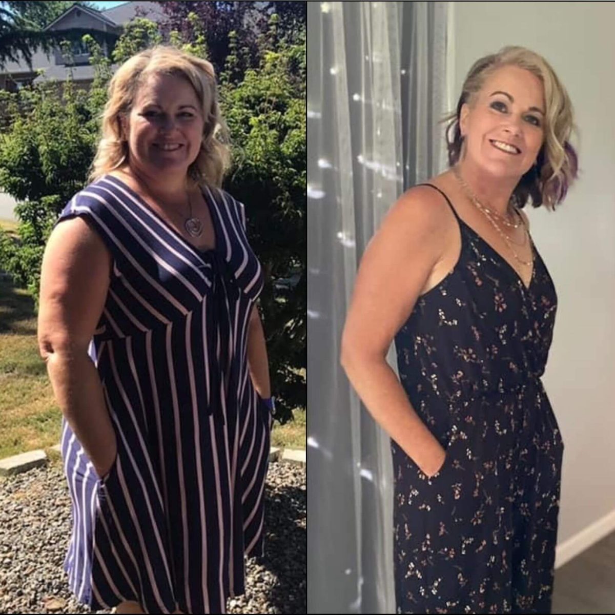 Two pictures of a woman before and after weight loss.